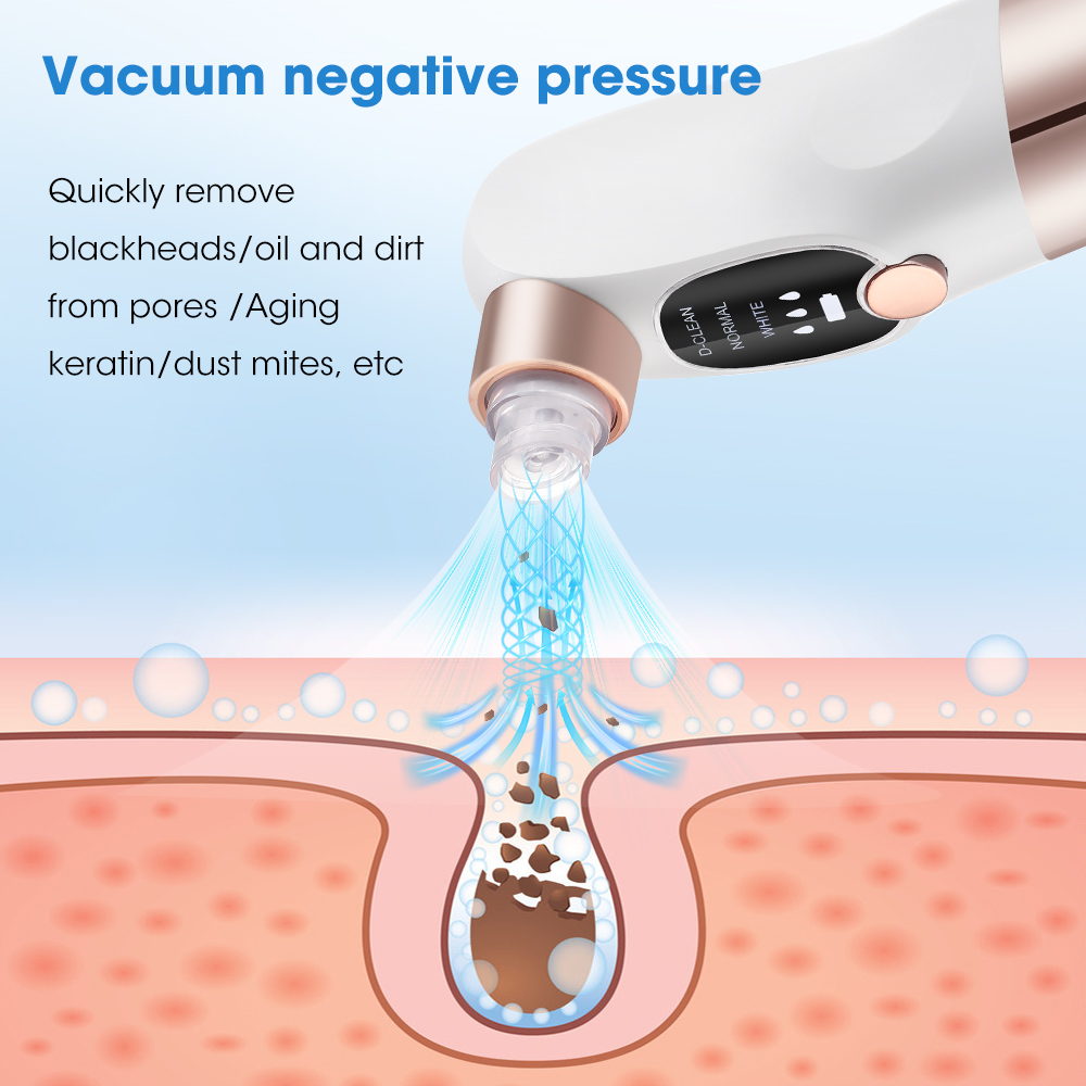 Electric Blackhead Remover, Va - Air Bubble Remover ulasan dan harga